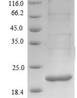 Mycobacterium bovis Alpha-crystallin (hspX) Recombinant Protein, N-His - BioCrest Sci