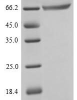 Human Eukaryotic peptide chain release factor GTP-binding subunit ERF3A (GSPT1) Recombinant Protein, N-10His/C-Myc - BioCrest Sci