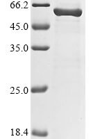 Arabidopsis thaliana Catalase-1 (CAT1) Recombinant Protein - BioCrest Sci