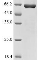 Human Coiled-coil domain-containing protein 112 (CCDC112) Recombinant Protein - BioCrest Sci