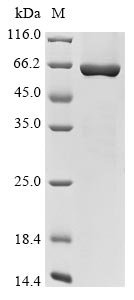 Human Coiled-coil domain-containing protein 112 (CCDC112) Recombinant Protein, Homo sapiens (Human), E.coli, N-terminal 10xHis-tagged and C-terminal Myc-tagged, 61.0 kDa, purity >≥ 85% as determined by SDS-PAGE.