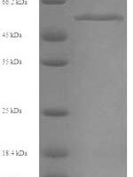 Human Mixed lineage kinase domain-like protein (MLKL) Recombinant Protein, N-His, aa 1–471, Yeast - BioCrest Sci