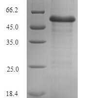 Saccharomyces cerevisiae Cystathionine beta-synthase (CYS4) Recombinant Protein - BioCrest Sci