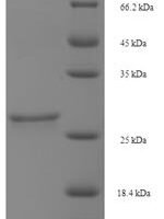 Sheep Somatoliberin (GHRH) Recombinant Protein - BioCrest Sci