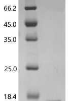 Human Homeobox protein Nkx-3.2 (Nkx3-2), partial Recombinant Protein, C-His, aa 150–250, E.coli - BioCrest Sci