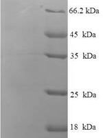Rat Disks large homolog 3 (Dlg3) Recombinant Protein - BioCrest Sci