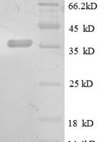 Rat Chemokine (C-X-C motif) ligand 13 (CXCL13), partial Recombinant Protein - BioCrest Sci