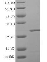 Human Lipopolysaccharide-responsive and beige-like anchor protein (LRBA), partial Recombinant Protein, N-His, aa 1267–1500 - BioCrest Sci