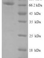 Human Protein FAM114A2 (FAM114A2) Recombinant Protein - BioCrest Sci