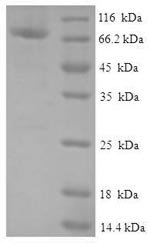 Human Protein FAM114A2 (FAM114A2) Recombinant Protein, Homo sapiens (Human), E.coli, N-terminal 6xHis-SUMO-tagged, 71.5 kDa, purity >≥ 90% as determined by SDS-PAGE.