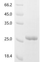 Mouse C-C chemokine receptor type 5 (Ccr5), partial Recombinant Protein - BioCrest Sci