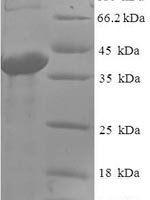 Human Abhydrolase domain-containing protein 14B (ABHD14B) Recombinant Protein, N-His-SUMO - BioCrest Sci