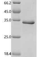Mouse Placenta-expressed transcript 1 protein (Plet1) Recombinant Protein, C-His - BioCrest Sci