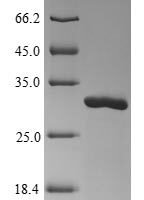 Bunyavirus La Crosse Nucleoprotein (N) Recombinant Protein - BioCrest Sci