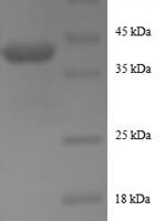 Human Active regulator of SIRT1 protein (RPS19BP1) Recombinant Protein - BioCrest Sci