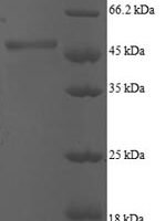 Human ADP-ribosylation factor 5 (ARF5) Recombinant Protein - BioCrest Sci