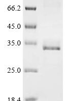 Human Podocin (NPHS2), partial Recombinant Protein - BioCrest Sci