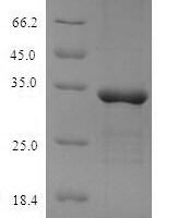 Mouse Meteorin-like protein (Metrnl) Recombinant Protein, N-His - BioCrest Sci