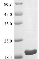 Human CMRF35-like molecule 7 (CD300LB), partial Recombinant Protein, N-10His - BioCrest Sci