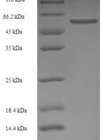 Rat Lutropin-choriogonadotropic hormone receptor (Lhcgr), partial Recombinant Protein, N-His-SUMO - BioCrest Sci