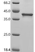Human Glyceraldehyde-3-phosphate dehydrogenase (GAPDH), Biotinylated Recombinant Protein - BioCrest Sci