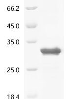 Human metapneumovirus Major surface glycoprotein G (G), partial Recombinant Protein, C-His, aa 52–219, Yeast - BioCrest Sci