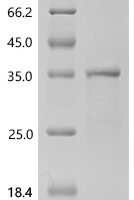 Human Asialoglycoprotein receptor 1 (ASGR1),partial Recombinant Protein - BioCrest Sci