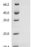 Pig Fibroblast growth factor (FGF2), Partial Recombinant Protein - BioCrest Sci