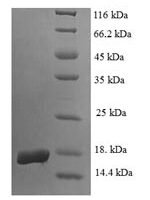 Human Egl nine homolog 2 (EGLN2), partial Recombinant Protein - BioCrest Sci