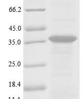Human Plasminogen (PLG), partial Recombinant Protein - BioCrest Sci