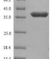 Human Anthrax toxin receptor 1 (ANTXR1), partial Recombinant Protein - BioCrest Sci