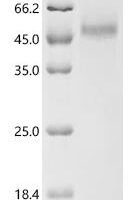 Zea mays Transcription factor TEOSINTE BRANCHED 1 (TB1) Recombinant Protein, C-His, aa 1–376, Zea mays (Maize) - BioCrest Sci