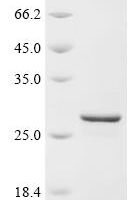 Human Very-long-chain (3R)-3-hydroxyacyl-CoA dehydratase 3 (HACD3), partial Recombinant Protein - BioCrest Sci