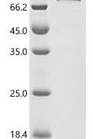 Human Exocyst complex component 5 (EXOC5) Recombinant Protein - BioCrest Sci