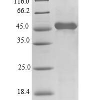 Human Alpha-tocopherol transfer protein (TTPA) Recombinant Protein, N-His-SUMO - BioCrest Sci