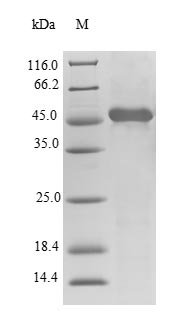Human Alpha-tocopherol transfer protein (TTPA) Recombinant Protein, N-His-SUMO, Homo sapiens (Human), E.coli, N-terminal 6xHis-SUMO-tagged, 47.7 kDa, purity >≥ 90% as determined by SDS-PAGE.