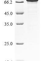 Human N(6)-adenosine-methyltransferase catalytic subunit METTL3 (METTL3) Recombinant Protein - BioCrest Sci