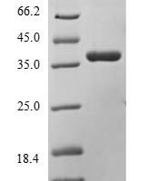 Human Protein delta homolog 1 (DLK1), partial Recombinant Protein, C-Flag-Myc - BioCrest Sci