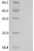 Human Acylglycerol kinase, mitochondrial (AGK) Recombinant Protein - BioCrest Sci