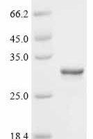 Human Peroxiredoxin-1(PRDX1) Recombinant Protein - BioCrest Sci