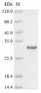 Human Peroxiredoxin-1(PRDX1) Recombinant Protein, Homo sapiens (Human), E.coli, N-terminal 10xHis-tagged and C-terminal Myc-tagged, 29.6 kDa, purity >≥ 95% as determined by SDS-PAGE.