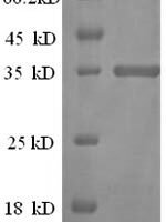 Mouse CD81 antigen (Cd81), partial Recombinant Protein - BioCrest Sci