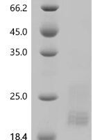 Rat Interferon gamma (Ifng) Recombinant Protein, C-10His - BioCrest Sci