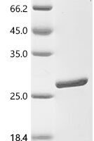 Rat Tumor necrosis factor (Tnf), partial Recombinant Protein - BioCrest Sci
