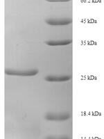 Human X-ray repair cross-complementing protein 5 (XRCC5), partial Recombinant Protein, N-His - BioCrest Sci