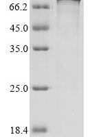 Human Transmembrane protease serine 2 (TMPRSS2), partial,Biotinylated Recombinant Protein - BioCrest Sci