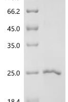 Porcine reproductive and respiratory syndrome virus Glycoprotein 4 (GP4), partial Recombinant Protein - BioCrest Sci