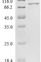 Human Probable ATP-dependent RNA helicase DDX5 (DDX5) Recombinant Protein - BioCrest Sci