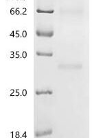 Human Claudin-18.2 (CLDN18.2)-Detergent Recombinant Protein - BioCrest Sci
