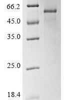 Human Vascular endothelial growth factor B (VEGFB) Recombinant Protein, N-10His-GST/C-Myc - BioCrest Sci